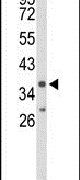 IL2RG Antibody in Western Blot (WB)