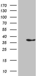 IL34 Antibody in Western Blot (WB)