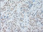 IL6 Antibody in Immunohistochemistry (Paraffin) (IHC (P))