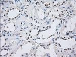 ILF2 Antibody in Immunohistochemistry (Paraffin) (IHC (P))