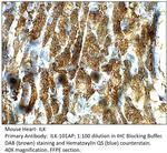 Integrin linked ILK Antibody in Immunohistochemistry (IHC)