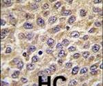 ILK Antibody in Immunohistochemistry (IHC)