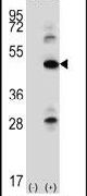 ILK Antibody in Western Blot (WB)
