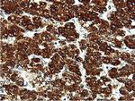 ILVBL Antibody in Immunohistochemistry (Paraffin) (IHC (P))