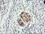 ILVBL Antibody in Immunohistochemistry (Paraffin) (IHC (P))