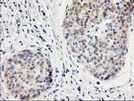 ILVBL Antibody in Immunohistochemistry (Paraffin) (IHC (P))