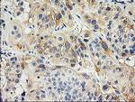 ILVBL Antibody in Immunohistochemistry (Paraffin) (IHC (P))