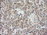 ILVBL Antibody in Immunohistochemistry (Paraffin) (IHC (P))