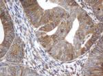 ILVBL Antibody in Immunohistochemistry (Paraffin) (IHC (P))