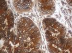 ILVBL Antibody in Immunohistochemistry (Paraffin) (IHC (P))