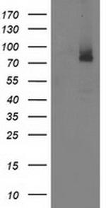 ILVBL Antibody in Western Blot (WB)