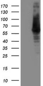ILVBL Antibody in Western Blot (WB)
