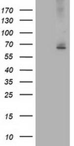 ILVBL Antibody in Western Blot (WB)