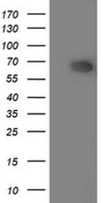 ILVBL Antibody in Western Blot (WB)