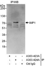 IMP1 Antibody in Immunoprecipitation (IP)