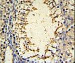 IMP3 Antibody in Immunohistochemistry (IHC)
