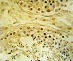 IMP4 Antibody in Immunohistochemistry (IHC)
