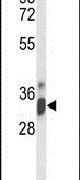 IMP4 Antibody in Western Blot (WB)