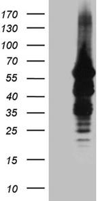 IMPDH2 Antibody in Western Blot (WB)