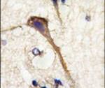 alpha Internexin Antibody in Immunohistochemistry (IHC)