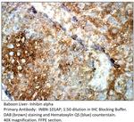 Inhibin alpha Antibody in Immunohistochemistry (IHC)