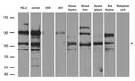 INCENP Antibody in Western Blot (WB)