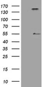 INHA Antibody in Western Blot (WB)