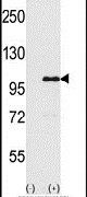 SHIP1 Antibody in Western Blot (WB)