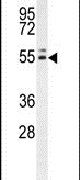 INSC Antibody in Western Blot (WB)