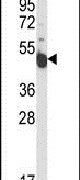 INSC Antibody in Western Blot (WB)