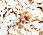 INSR Antibody in Immunohistochemistry (IHC)