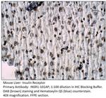 Insulin Receptor Polyclonal Antibody