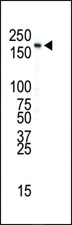 INSR Antibody in Western Blot (WB)