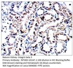 Integrin beta 3 Antibody in Immunohistochemistry (IHC)