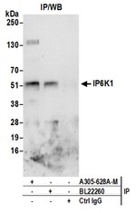 IP6K1 Antibody in Western Blot (WB)