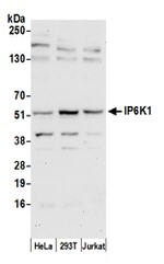IP6K1 Polyclonal Antibody