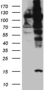 IPO5 Antibody in Western Blot (WB)