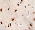 IQCJ Antibody in Immunohistochemistry (IHC)