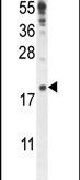 IQCJ Antibody in Western Blot (WB)
