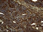 IQGAP1 Antibody in Immunohistochemistry (Paraffin) (IHC (P))