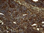 IQGAP1 Antibody in Immunohistochemistry (Paraffin) (IHC (P))