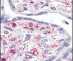 IRAK1 Antibody in Immunohistochemistry (IHC)