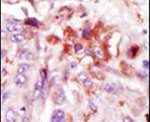 IRAK1 Antibody in Immunohistochemistry (IHC)