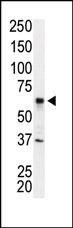 IRAK2 Antibody in Western Blot (WB)