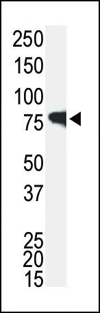 IRAK1 Antibody in Western Blot (WB)
