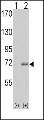 IRAK1 Antibody in Western Blot (WB)