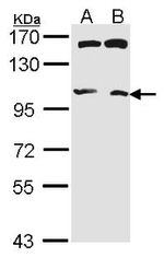 IRE1 alpha Antibody in Western Blot (WB)