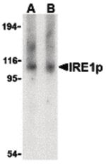 IRE1 alpha Antibody in Western Blot (WB)