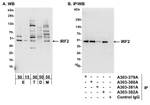 IRF2 Antibody in Western Blot (WB)