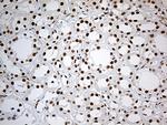 IRF2BP1 Antibody in Immunohistochemistry (Paraffin) (IHC (P))